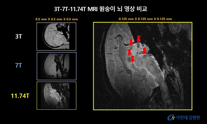 MRI 자기장 세기별 원숭이 뇌영상 비교. 가천대 길병원이 개발한 11.74T MRI를 이용한 영상에서는 기존 MRI 영상에서 확인하기 어렵던 세포핵(화살표 표기)이 더욱 선명하게 확인 가능하다. 사진=길병원