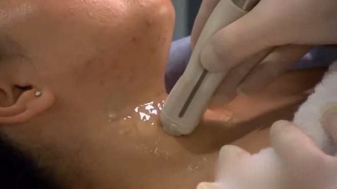 갑상선 검진 사진=연합뉴스TV 