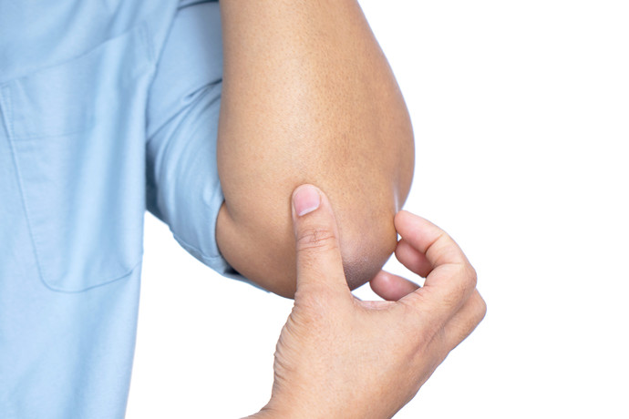 건선 사진제공 클립아트코리아